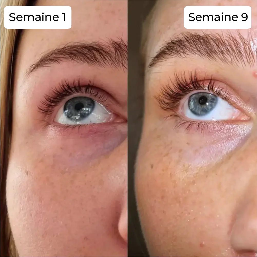 Before and After 2
