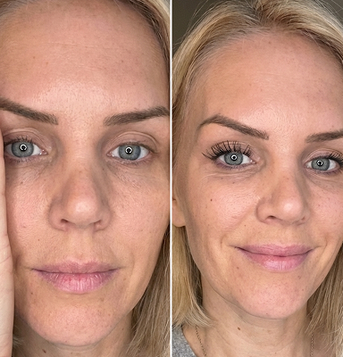 Laura, 58
