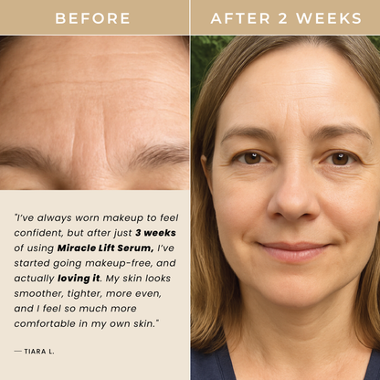 Miracle Lift Serum