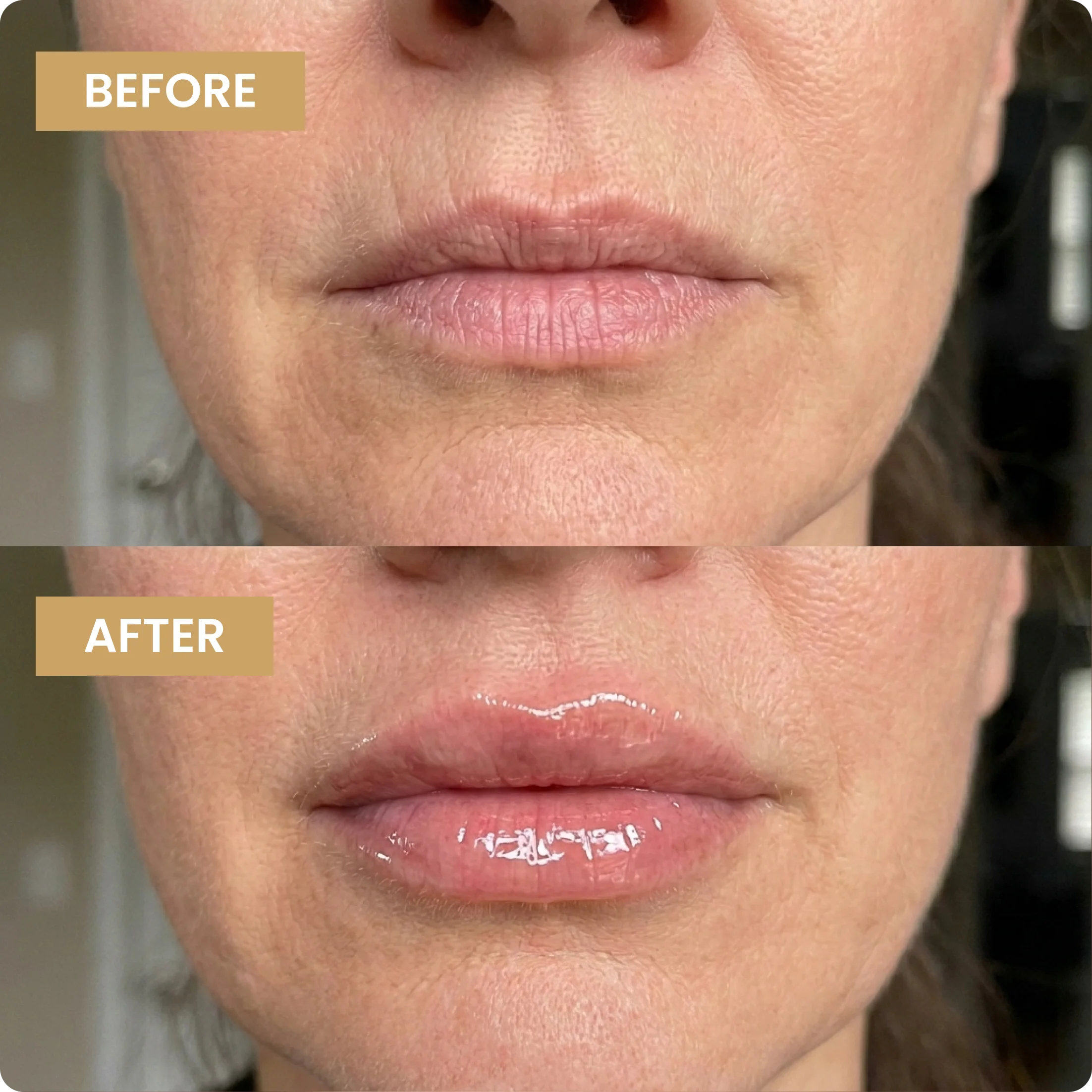 <p>1. Makes Lips Look Fuller In Minutes</p>