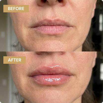 Kehyla Beauty - Lip Plumper