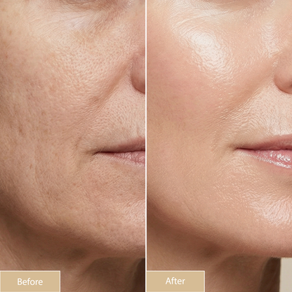 Glass Skin Set - Miracle Lift Serum + Pure Glow C Serum